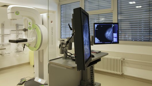 Verbesserte Untersuchungsmöglichkeit im Brustzentrum Kreis Recklinghausen, Paracelsus-Klinik Marl